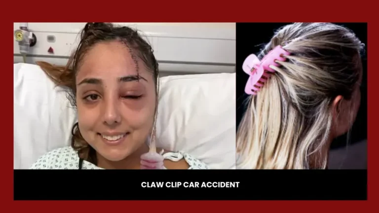 claw clip car accident